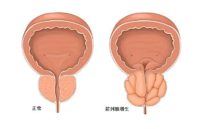 兩性健康 | 對于女性來說，最怕男人得什么??？(圖1)