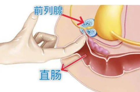 是時(shí)候重視了，1分鐘自測前列腺健康，達標的不多